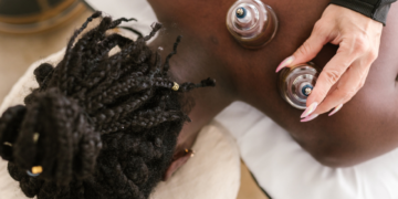 Cupping Therapy being performed on a patient