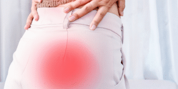 Understanding and Managing Sciatica with Physiotherapy