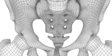 Understanding Hypertonic Pelvic Floor