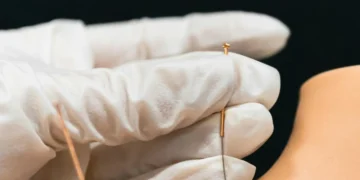 Dry needling therapy for muscle pain relief