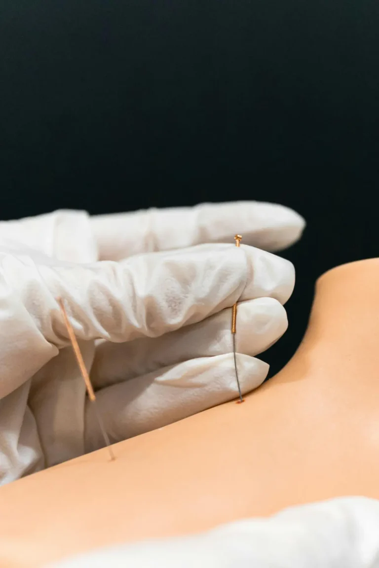 Dry needling therapy for muscle pain relief